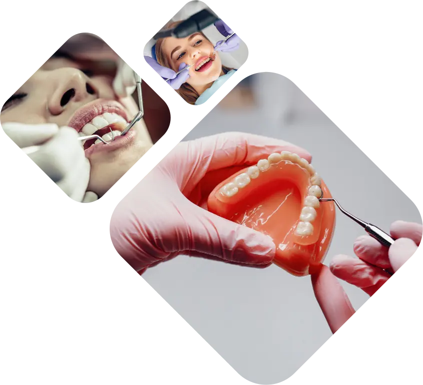 Dental Pattern